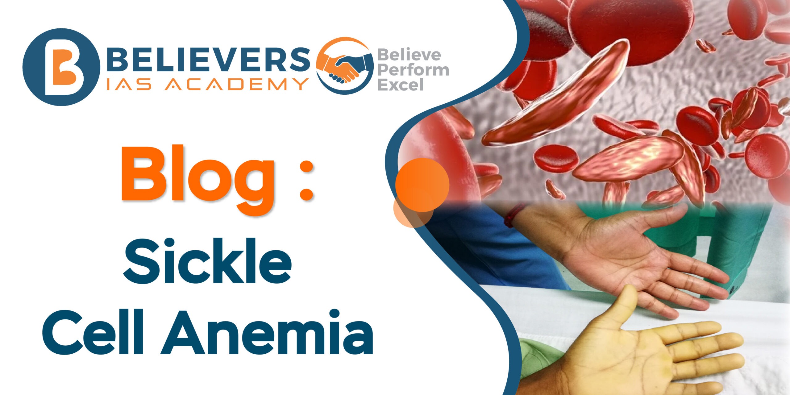 Blog: Sickle Cell